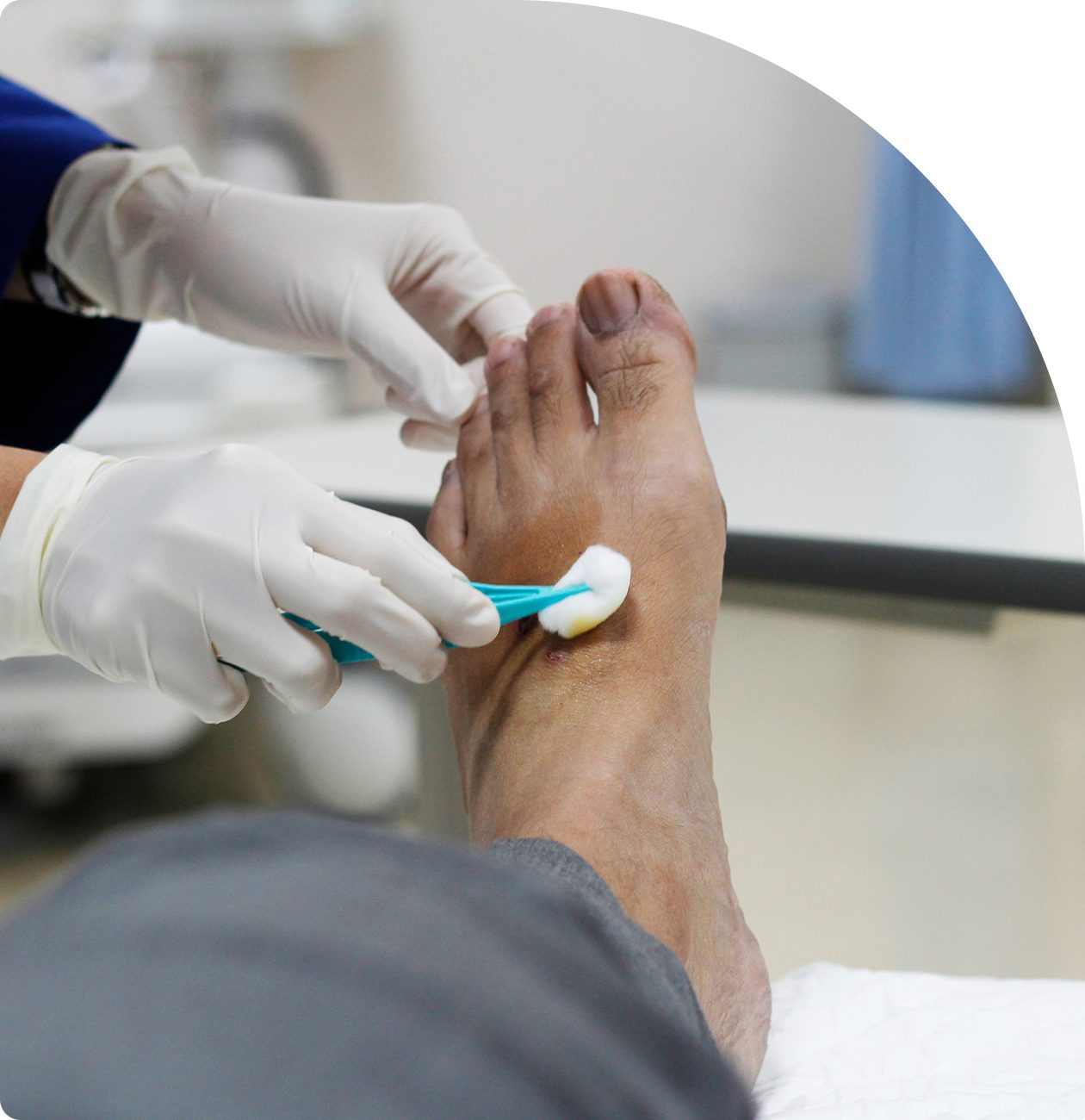 Foot wound being cleaned with medical tool.